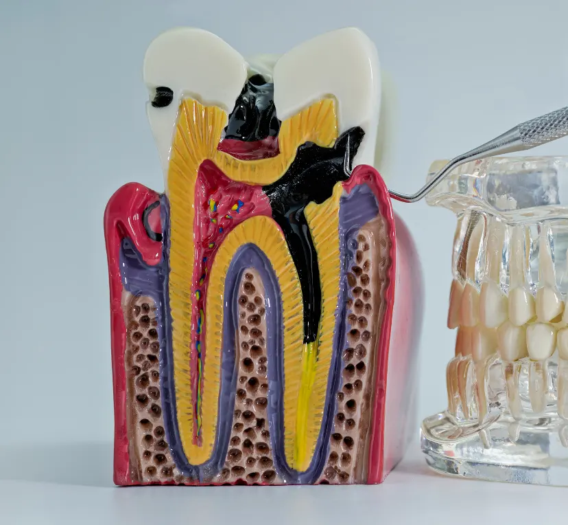 Comfortable root canal treatment and recovery care at Northshore Family Dental in Flower Mound, TX